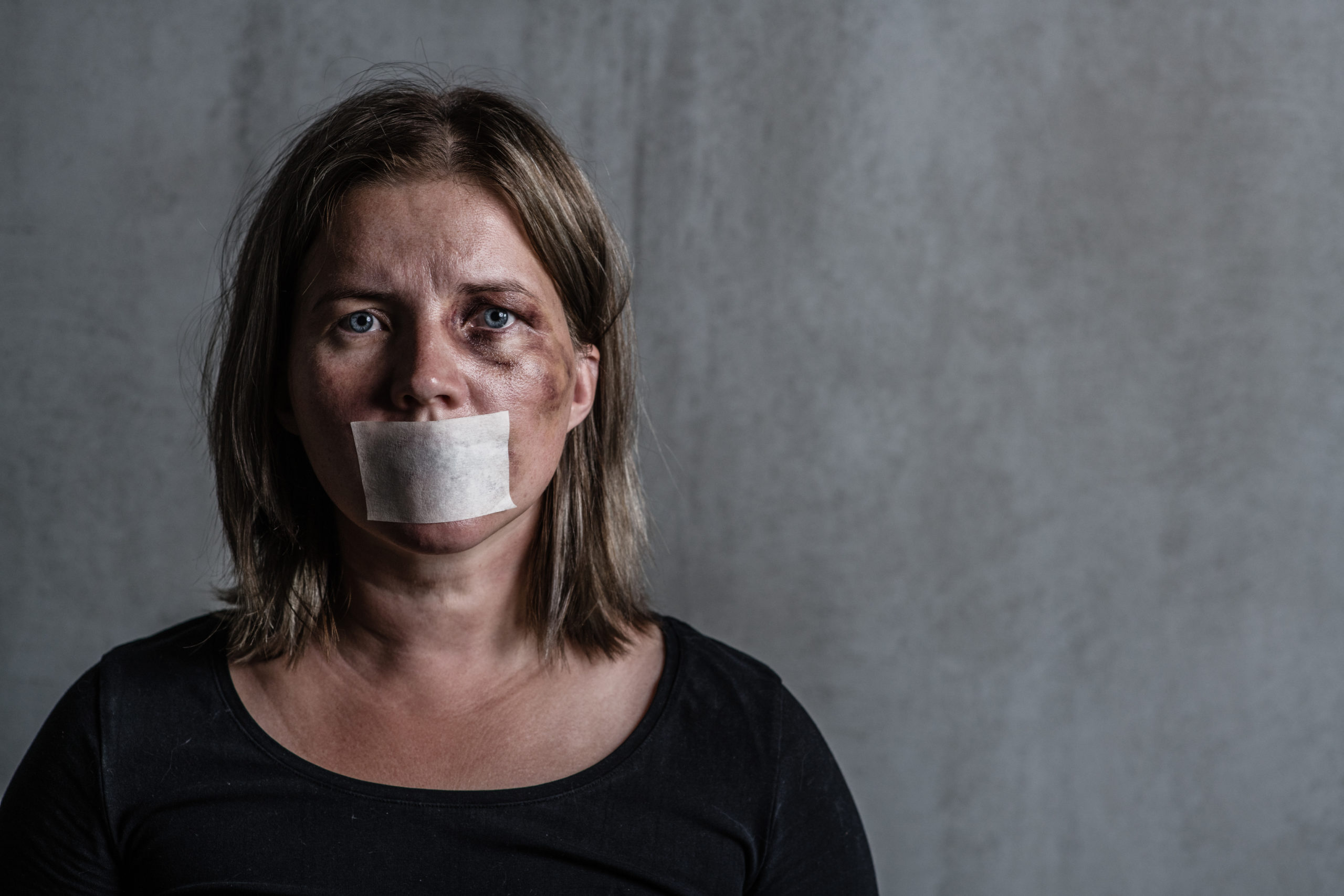 Beaten up woman victim of domestic violence and abusewith covered her mouth.